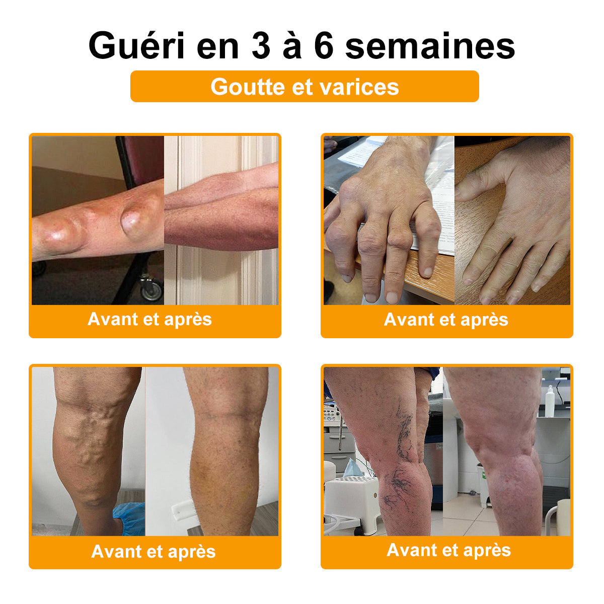 ADNOON® CRÈME DE GUÉRISON DES OS ET DE SOULAGEMENT DE LA DOULEUR AU BOTOX ET VENIN D'ABEILLE
