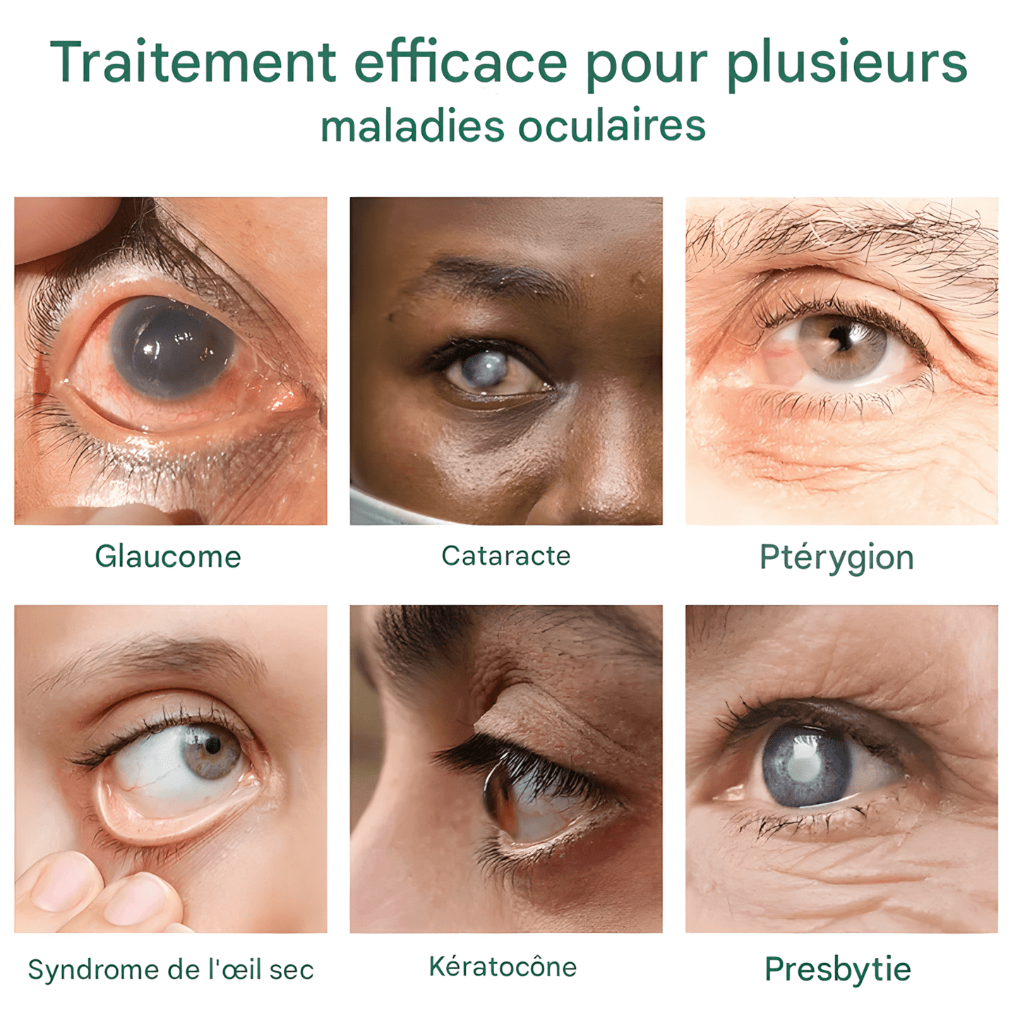 SÉRUM GOUTTES POUR LES YEUX OURLYARD – SOULAGEMENT NATUREL ET HYDRATANT INSTANTANÉ
