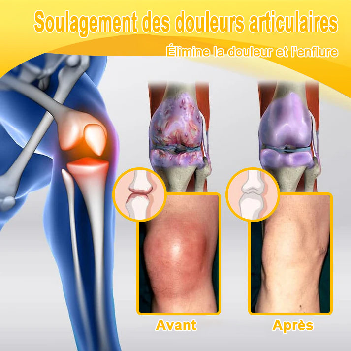ADNOON® CRÈME DE GUÉRISON DES OS ET DE SOULAGEMENT DE LA DOULEUR AU BOTOX ET VENIN D'ABEILLE