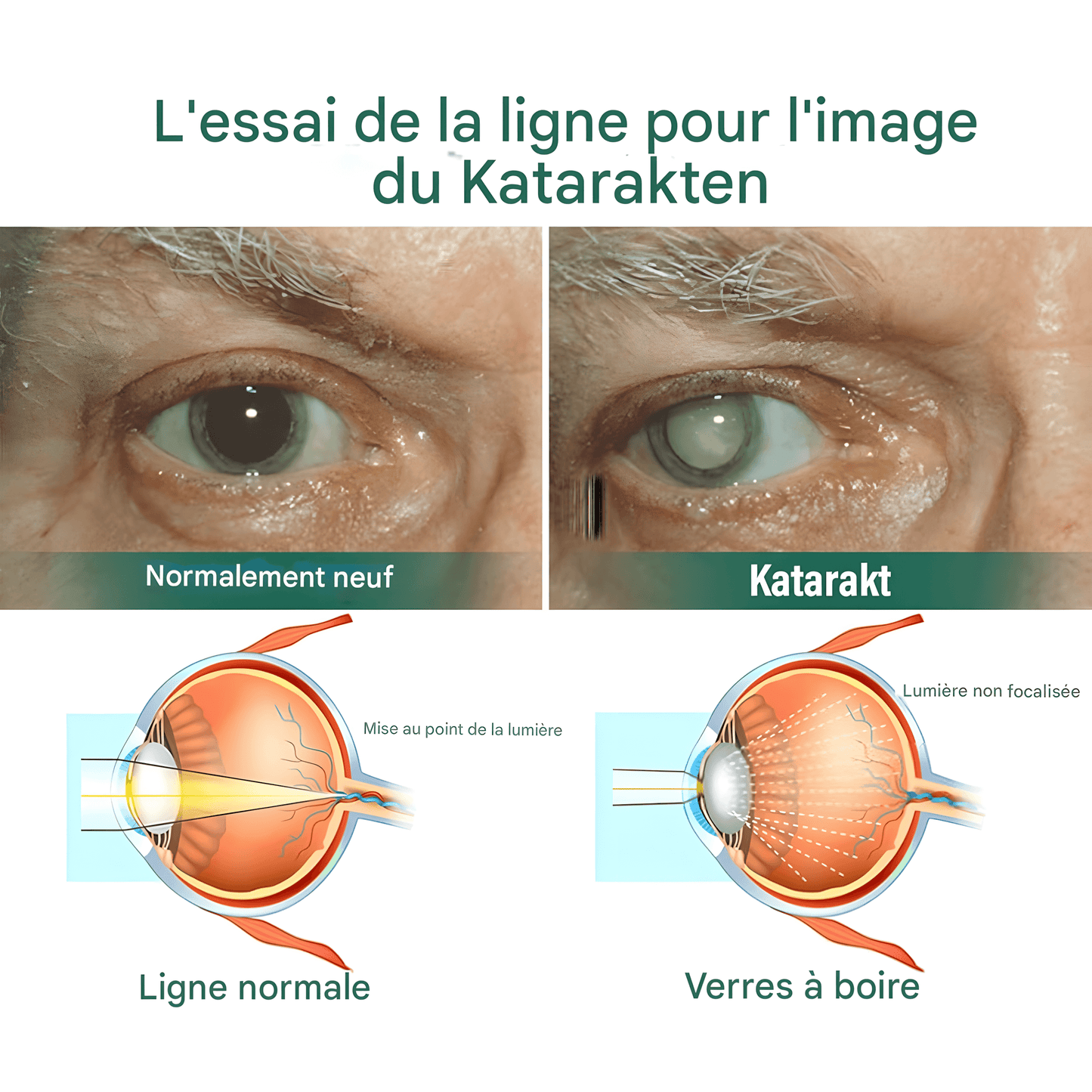 SÉRUM GOUTTES POUR LES YEUX OURLYARD – SOULAGEMENT NATUREL ET HYDRATANT INSTANTANÉ