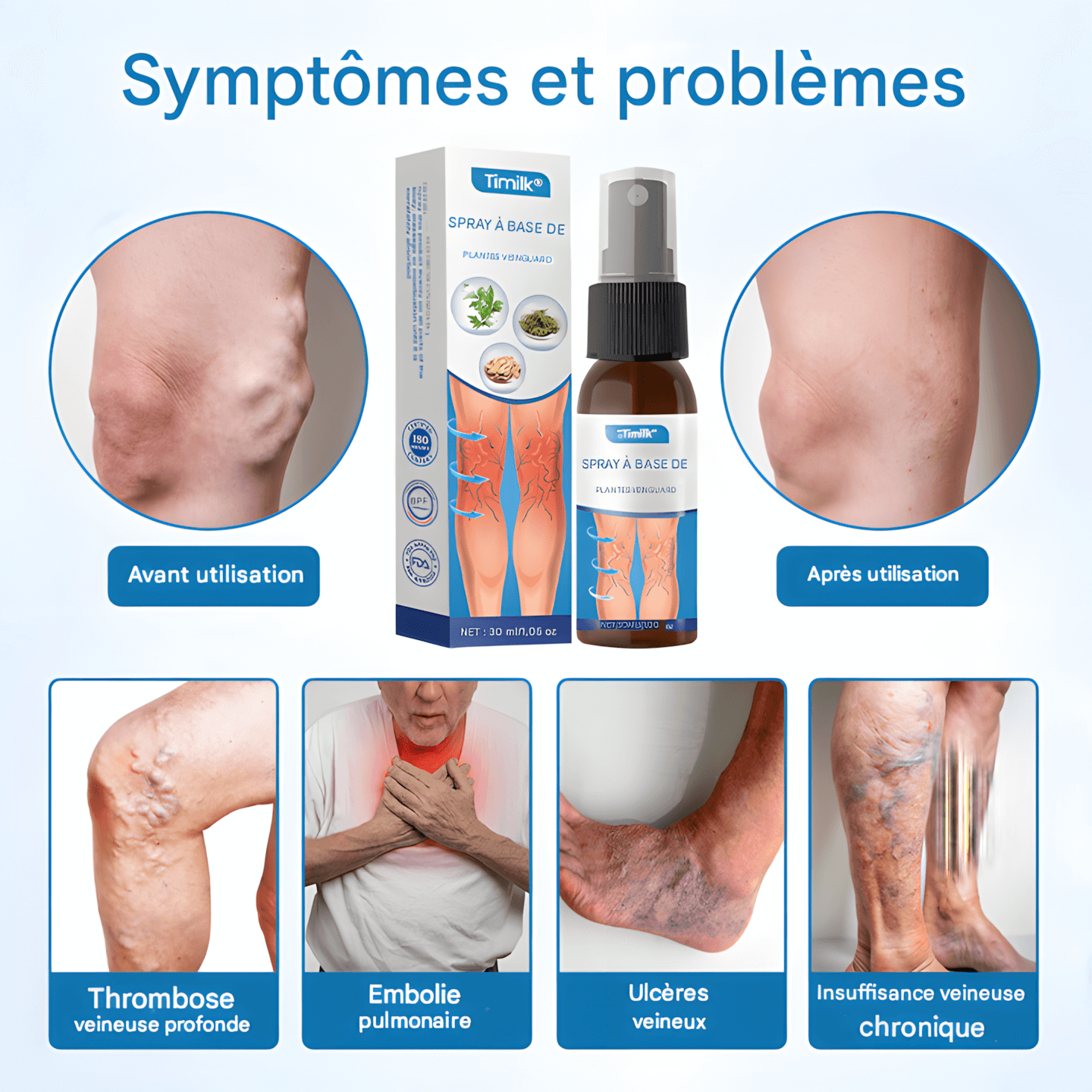 "SPRAY NATUREL ANTI-VARICES – RÉSULTATS VISIBLES DÈS 7 JOURS !"
