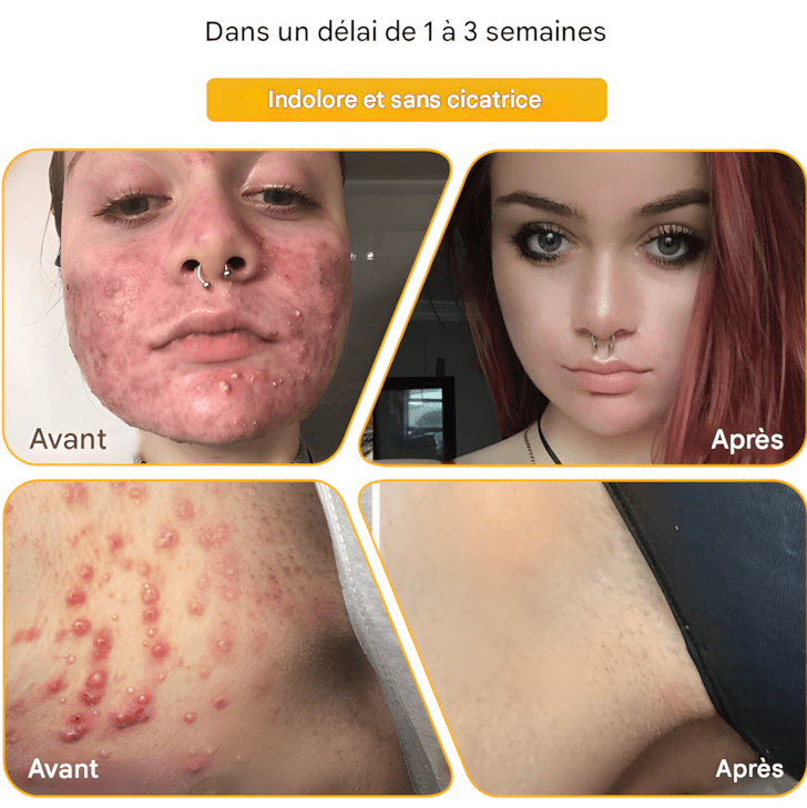 CRÈME AU VENIN D'ABEILLE – RÉVOLUTION SKINCARE POUR UNE PEAU PARFAITE