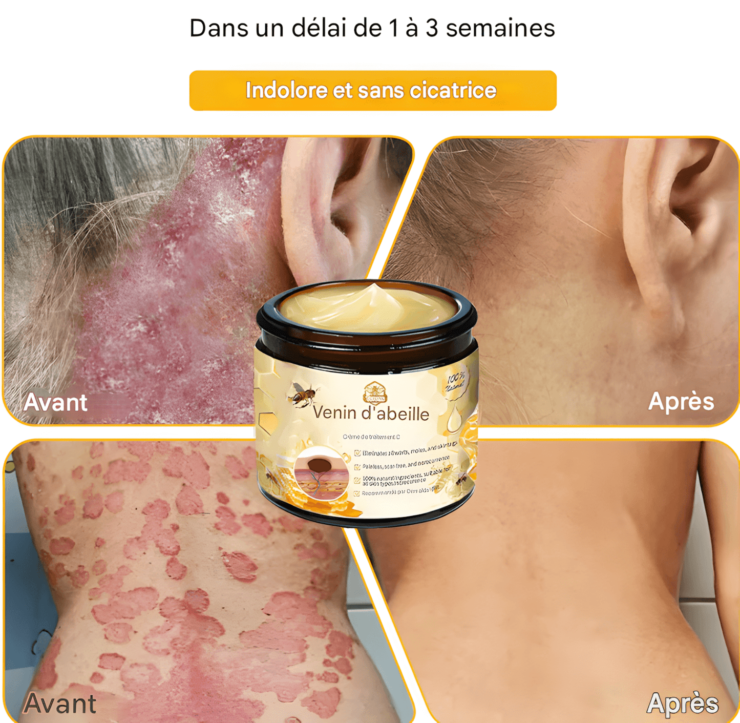 CRÈME AU VENIN D'ABEILLE – RÉVOLUTION SKINCARE POUR UNE PEAU PARFAITE