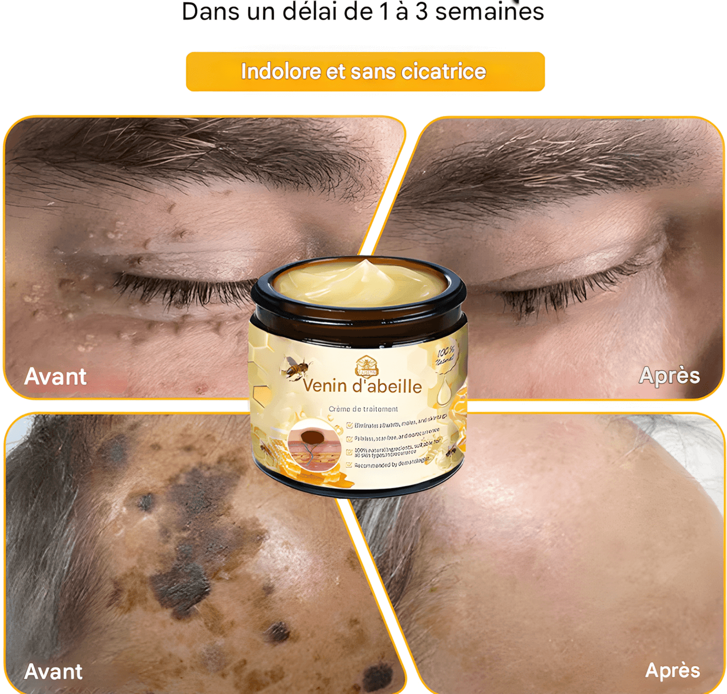 CRÈME AU VENIN D'ABEILLE – RÉVOLUTION SKINCARE POUR UNE PEAU PARFAITE
