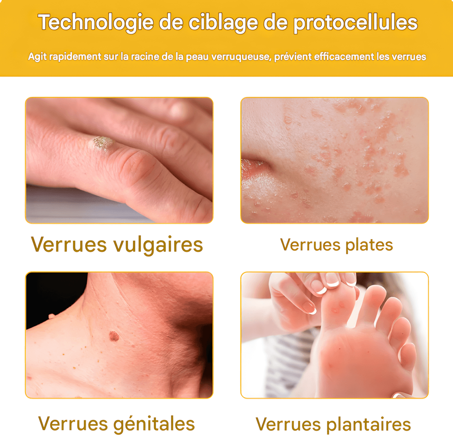 CRÈME AU VENIN D'ABEILLE – RÉVOLUTION SKINCARE POUR UNE PEAU PARFAITE