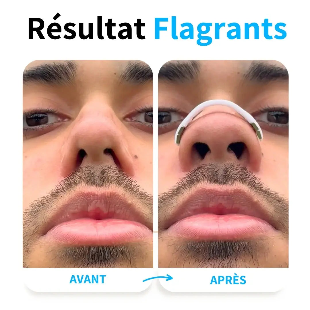 BANDES MAGNÉTIQUES POUR LE NEZ AFIN D'AMÉLIORER LA RESPIRATION ET FAVORISER LE CONFORT