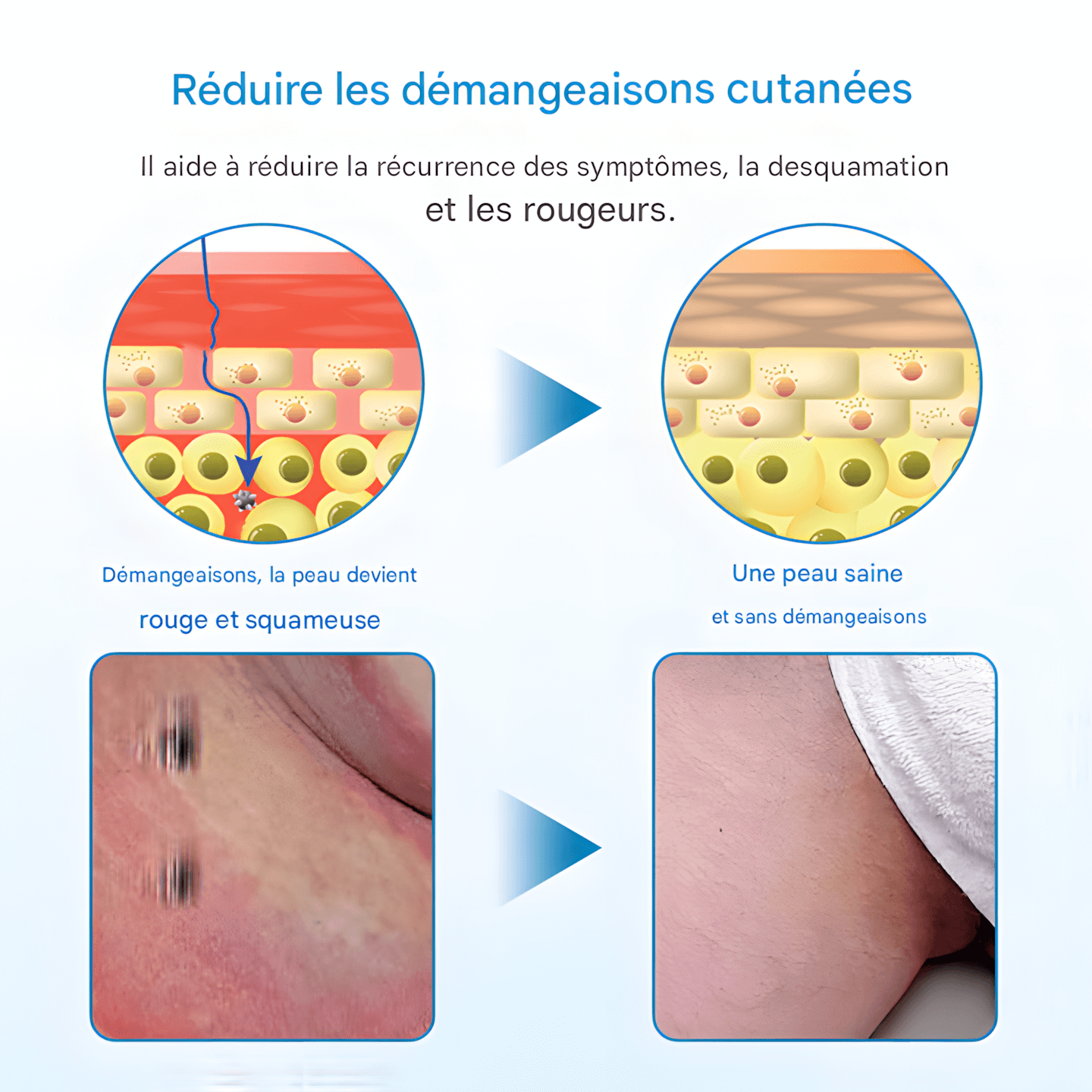 CRÈME ANTIBACTÉRIENNE HOMME MAGISEL – CONFORT INTIME QUOTIDIEN PROTECTION DOUCE