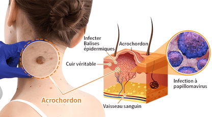 CRÈME AU VENIN D'ABEILLE – RÉVOLUTION SKINCARE POUR UNE PEAU PARFAITE
