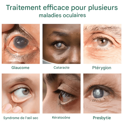 SÉRUM GOUTTES POUR LES YEUX OURLYARD – SOULAGEMENT NATUREL ET HYDRATANT INSTANTANÉ
