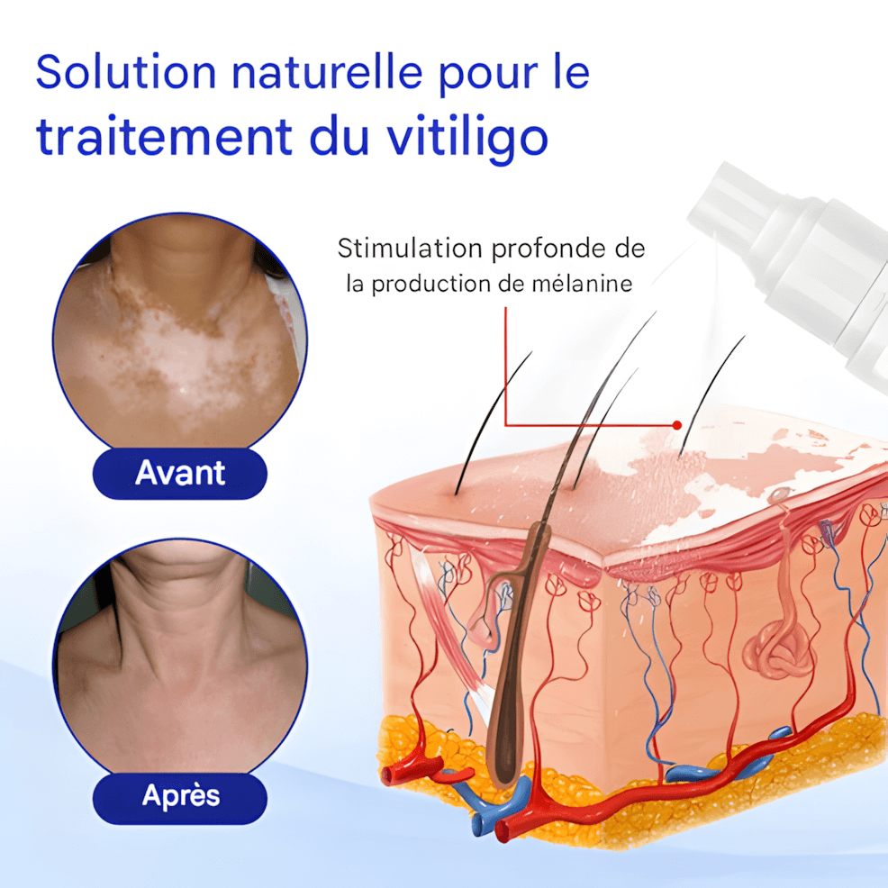 ÉCLAT NATUREL – SPRAY CORRECTEUR DE TEINT 🌟