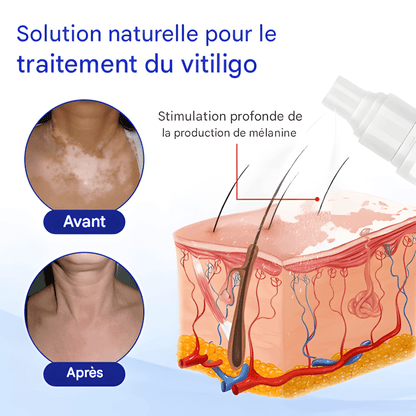 ÉCLAT NATUREL – SPRAY CORRECTEUR DE TEINT 🌟