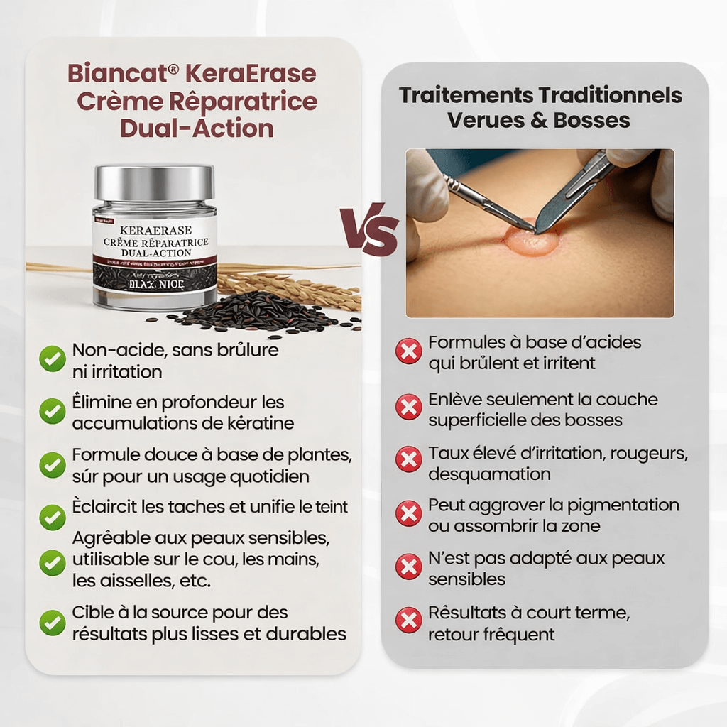 CUREVIVO KERAERASE – CRÈME DOUBLE ACTION ANTI-IMPERFECTIONS, RÉGÉNÉRATION & ÉCLAT VISIBLES ✨