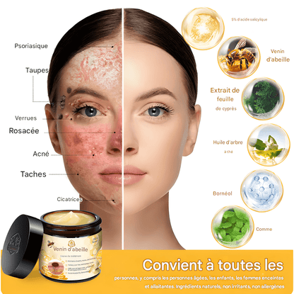 CRÈME AU VENIN D'ABEILLE – RÉVOLUTION SKINCARE POUR UNE PEAU PARFAITE