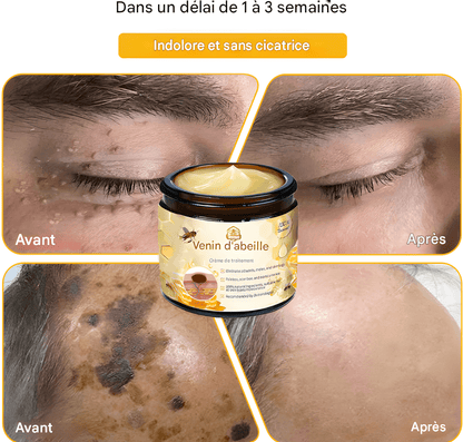 CRÈME AU VENIN D'ABEILLE – RÉVOLUTION SKINCARE POUR UNE PEAU PARFAITE