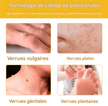 CRÈME AU VENIN D'ABEILLE – RÉVOLUTION SKINCARE POUR UNE PEAU PARFAITE