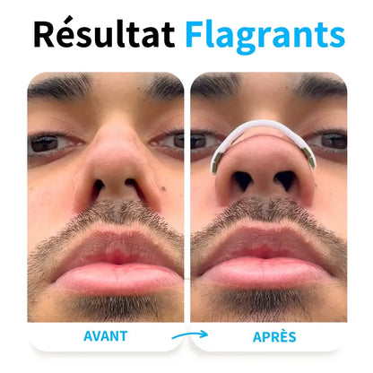 BANDES MAGNÉTIQUES POUR LE NEZ AFIN D'AMÉLIORER LA RESPIRATION ET FAVORISER LE CONFORT